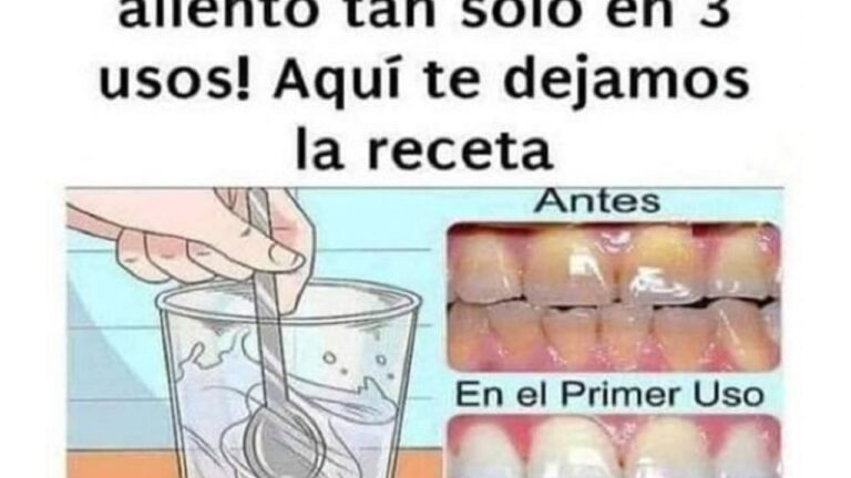 Blanquea tus dientes: Elimina el sarro y la gingivitis con esta receta ...